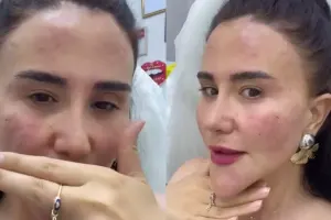 Aparıcının yeni görünüşü müzakirə yaratdı - Video