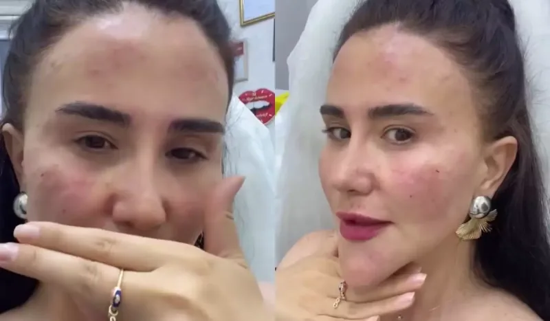 Aparıcının yeni görünüşü müzakirə yaratdı - Video