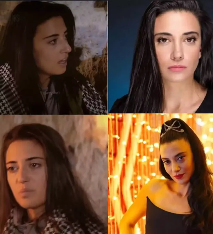 “Nursema”nın estetikdən əvvəlki halı diqqət çəkdi