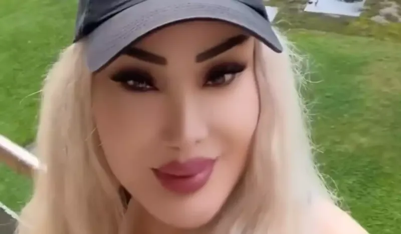 Məleykə Əsədova estetik etdirib?