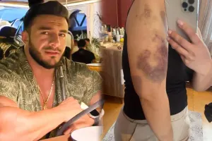 Eks-sevgilisindən Hidayətə ittihamlar - “550 min pulumu ələ keçirib, məni dəfələrlə döyüb”