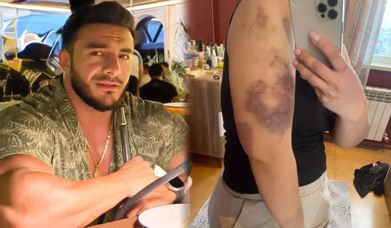 Eks-sevgilisindən Hidayətə ittihamlar - “550 min pulumu ələ keçirib, məni dəfələrlə döyüb”