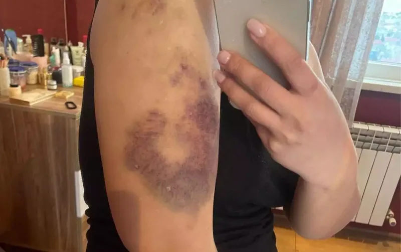 Eks-sevgilisindən Hidayətə ittihamlar - “550 min pulumu ələ keçirib, məni dəfələrlə döyüb”