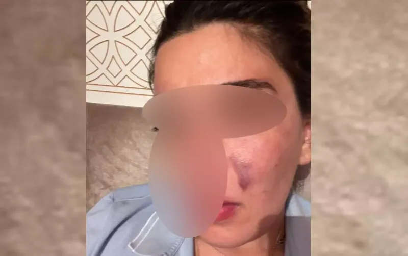 Eks-sevgilisindən Hidayətə ittihamlar - “550 min pulumu ələ keçirib, məni dəfələrlə döyüb”