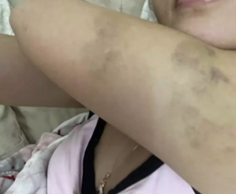 Eks-sevgilisindən Hidayətə ittihamlar - “550 min pulumu ələ keçirib, məni dəfələrlə döyüb”