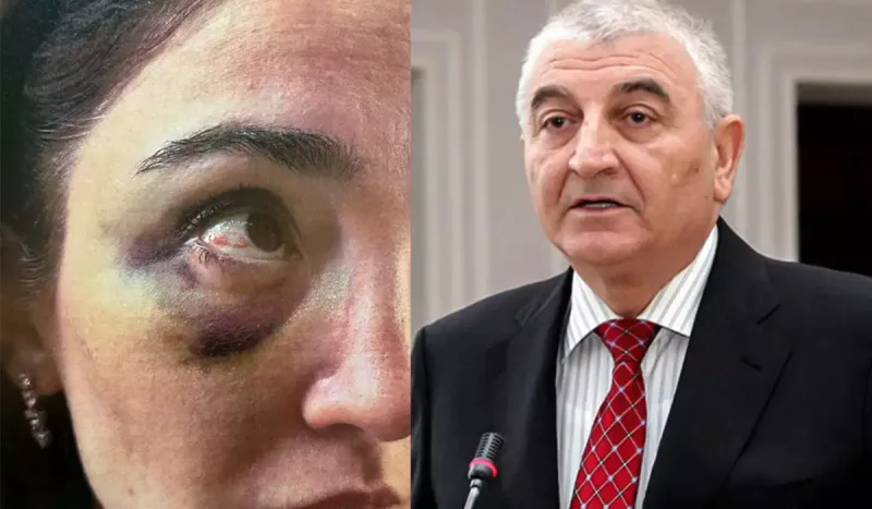 Məzahir Pənahovun oğlu keçmiş arvadına uduzdu