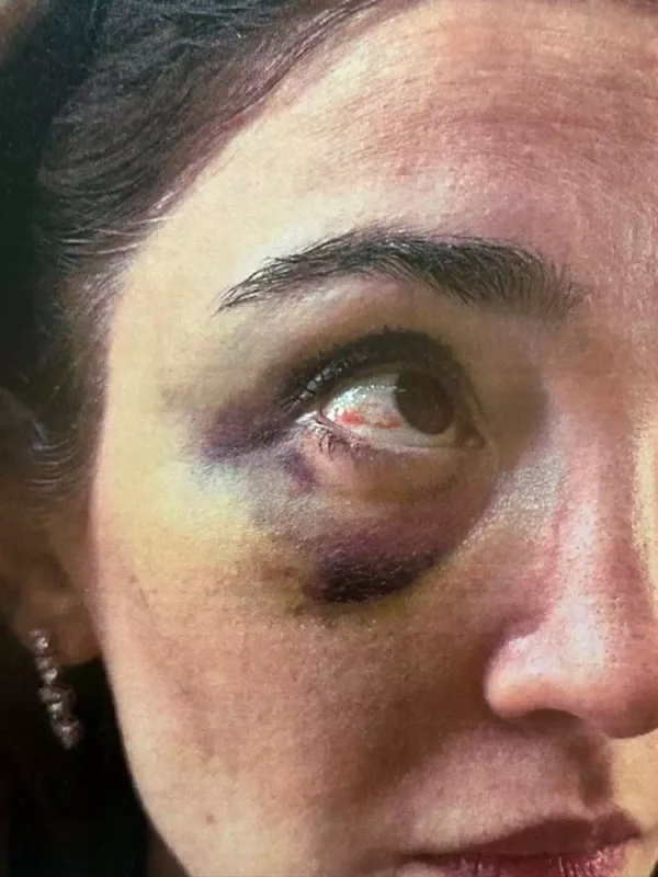 Məzahir Pənahovun oğlu keçmiş arvadına uduzdu