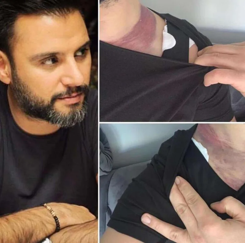 Plastik cərrahından 2 milyon tələb edir- FOTO