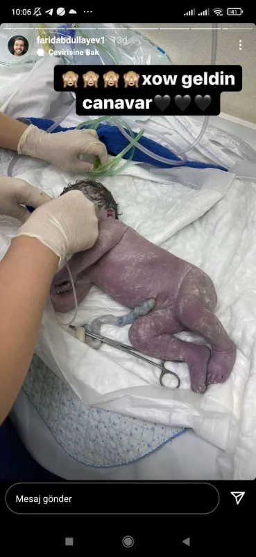 Fəridlə Nagehanın ikinci övladı dünyaya gəldi - FOTO