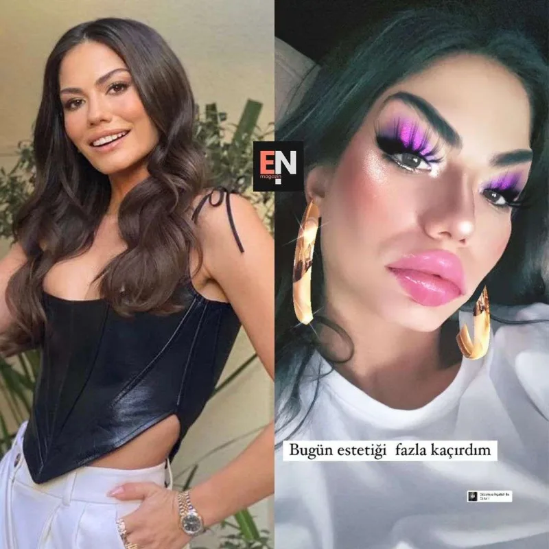 Estetik iddialarına bu cür cavab verdi