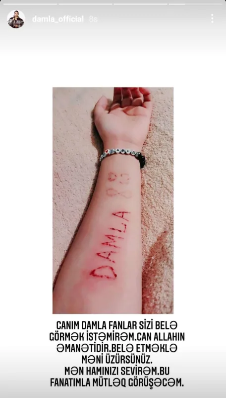 Fanatı Damla üçün qolunu kəsdi