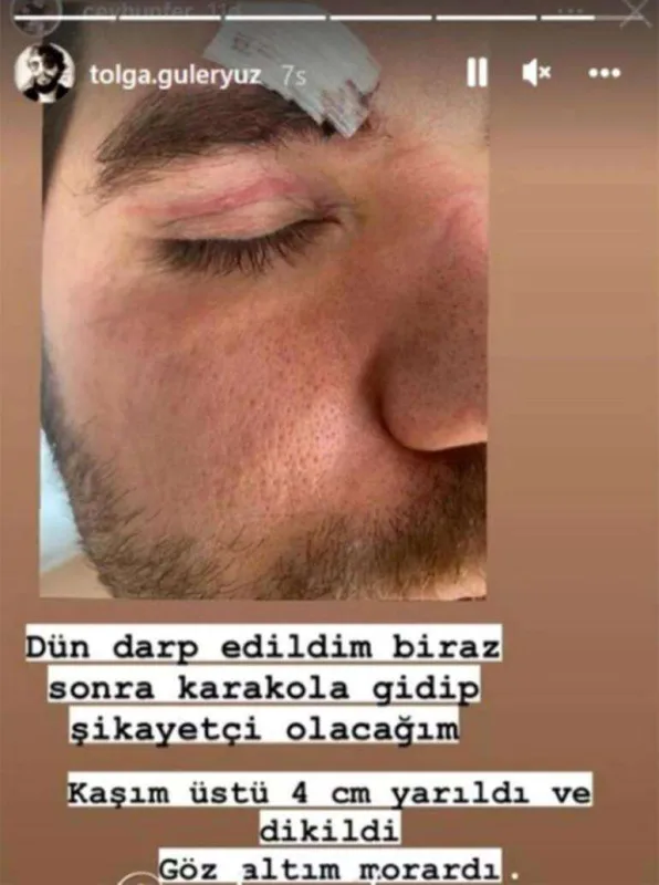 Aktyora hücum edib, döydülər