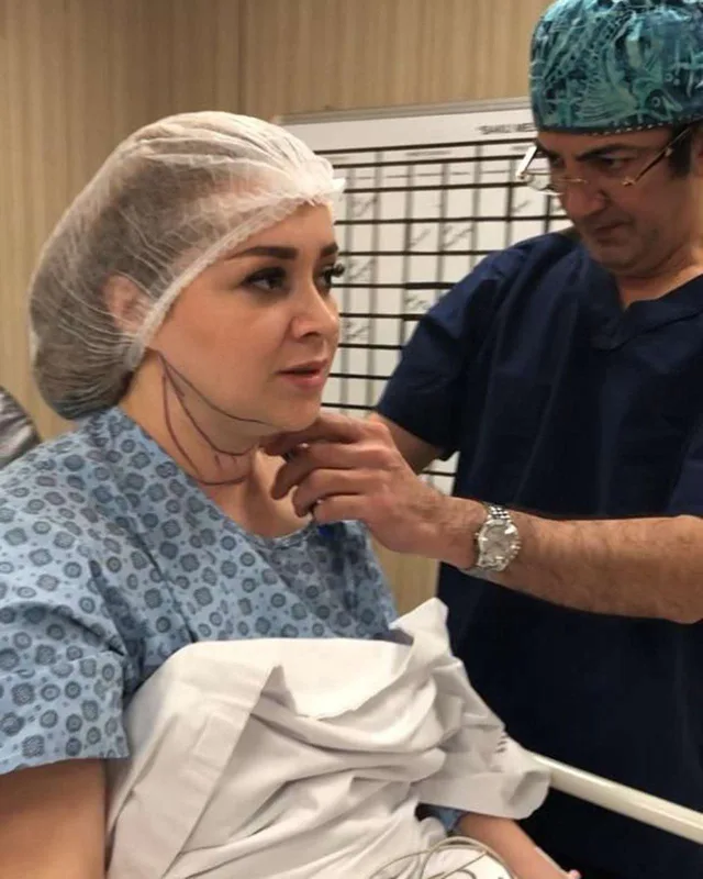 Xatirə üzündə də estetik etdirdi