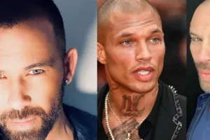 Berksanın estetik əməliyyatı lağa qoyuldu