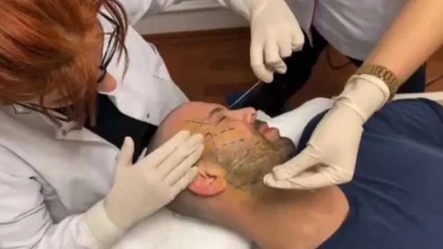 Berksanın estetik əməliyyatı lağa qoyuldu