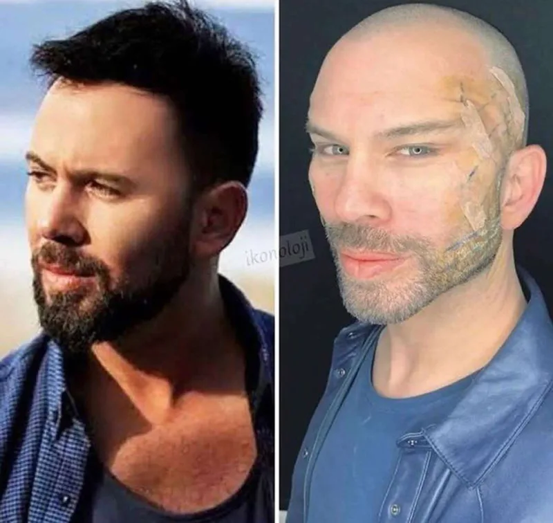 Estetik əməliyyatı ilə bağlı açıqlama yaydı