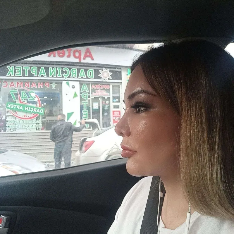 Ülvira estetiklə üzünü dəyişdirdi