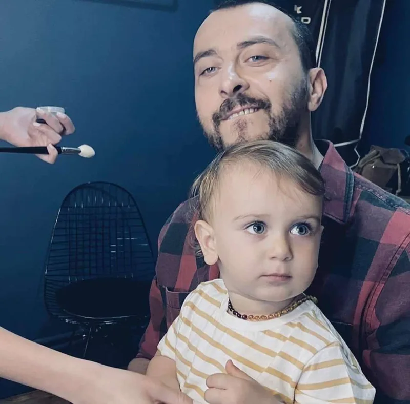 Hazalın əri saç əkdirdi