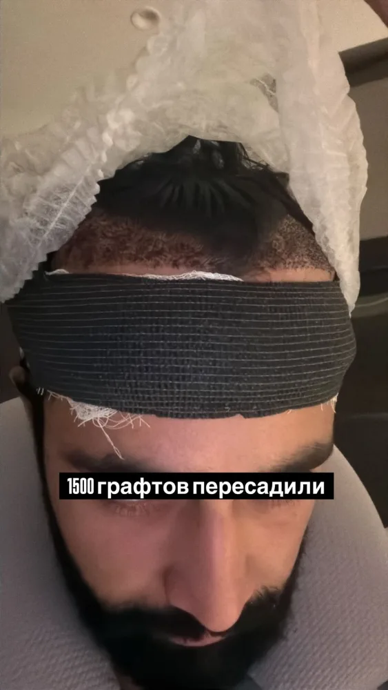 Hüseyn Həsənov əməliyyat olundu