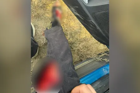 AzTV-nin müxbiri təyyarənin qəzaya düşdüyü ərazidə yaralandı