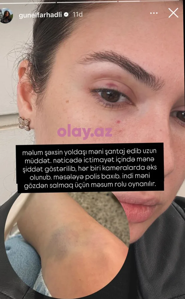 Canananın əri Günelə şiddət göstərib