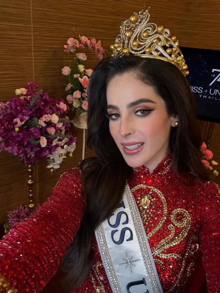  “Kainat gözəli”  o oldu!