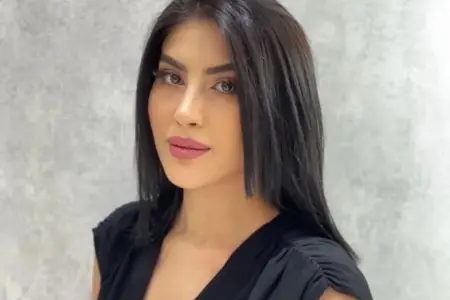 Tiktoker Ləmanın üzü yanıb