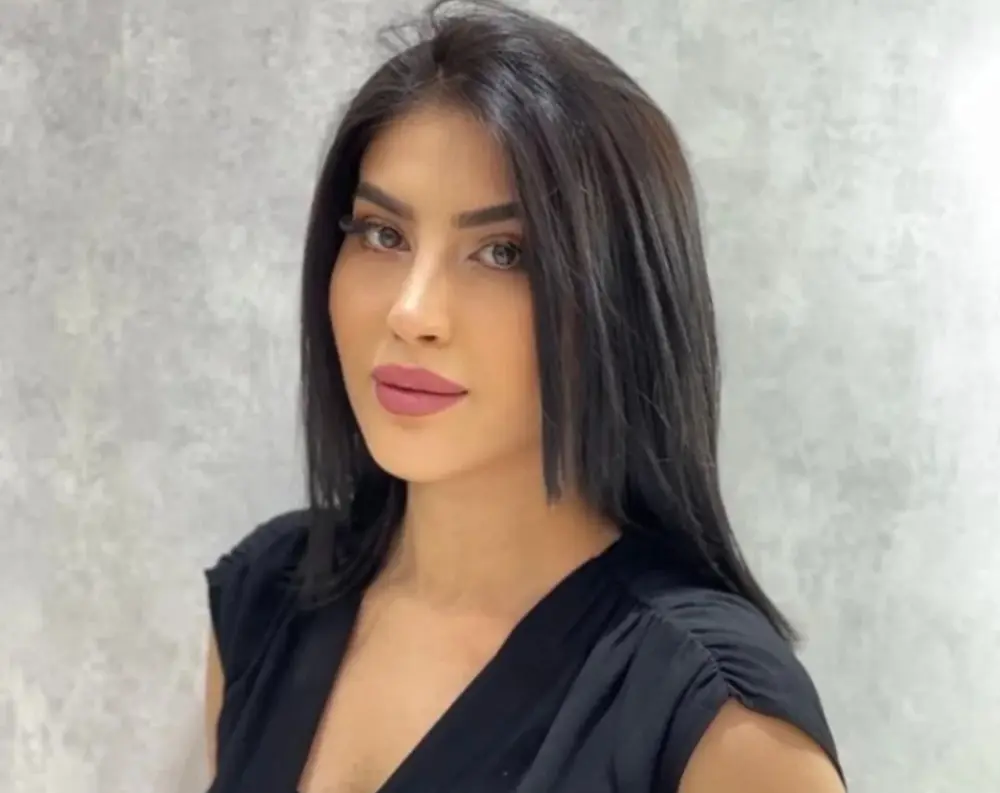 Tiktoker Ləmanın üzü yanıb