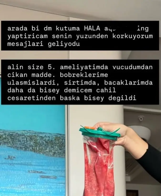 Danla 5-ci dəfə dolğu təmizləmə əməliyyatı etdirdi