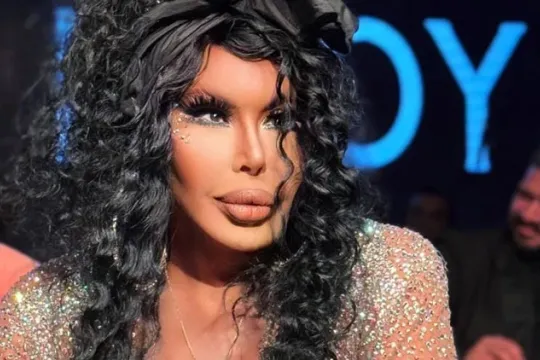 Onu yaxından çəkən jurnalistə qışqırdı