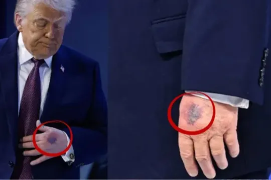 Yenə əlləri ilə gündəm oldu