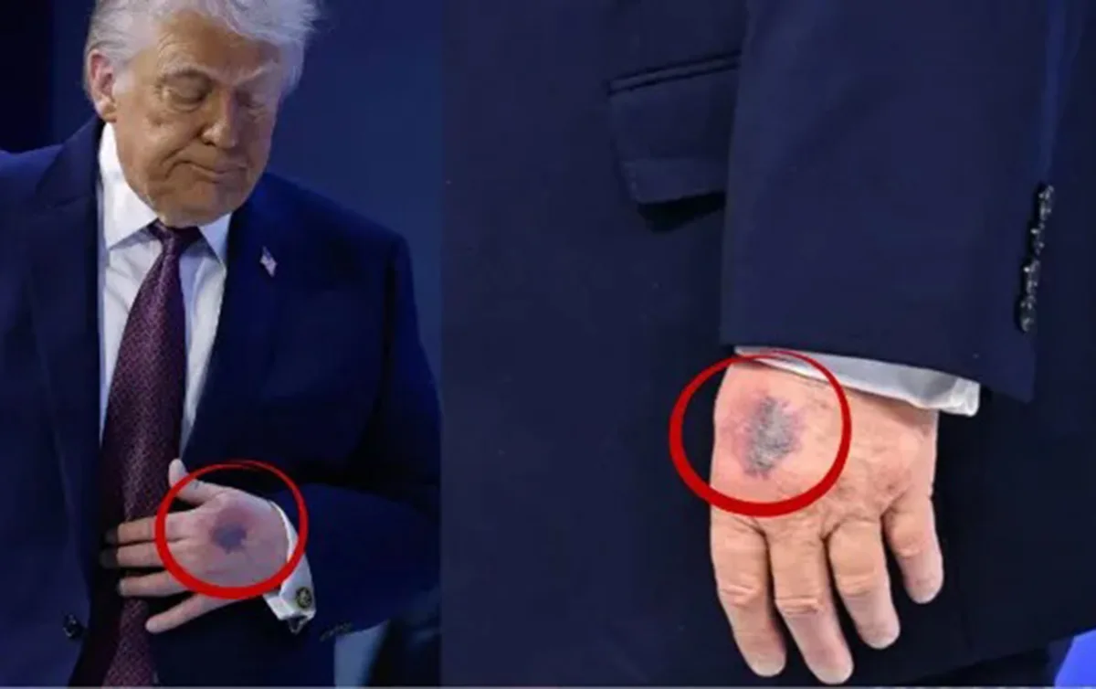 Yenə əlləri ilə gündəm oldu