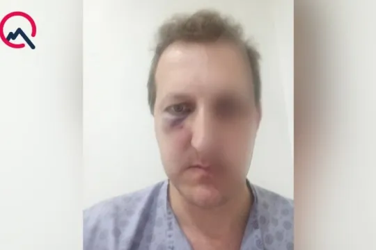 Bakıda Xalq artistinin oğlunu döydülər