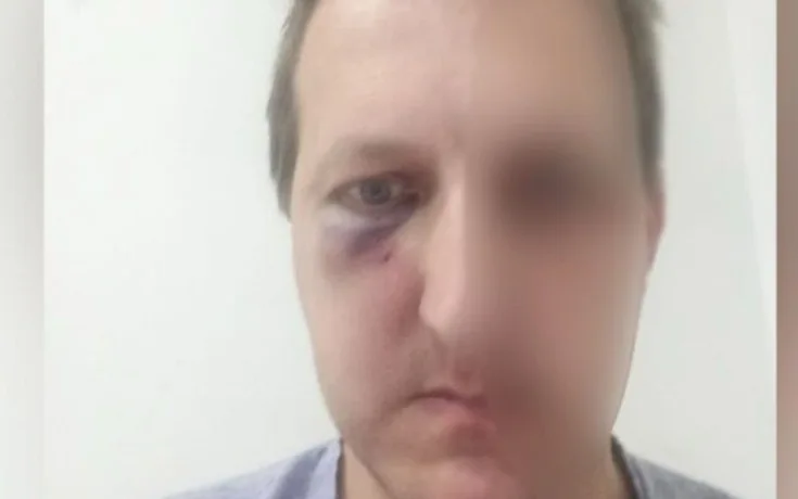 Xalq artistinin oğlunu döyənlər saxlanıldı