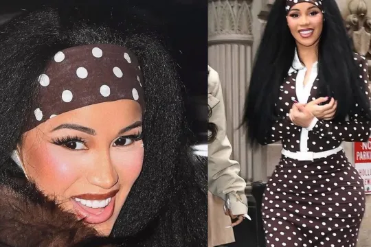 Kardi Bi-nin üzündəki dəyişiklik diqqət çəkdi