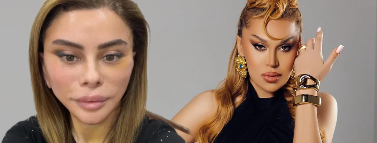 Üzgərmə əməliyyatı etdirdilər!