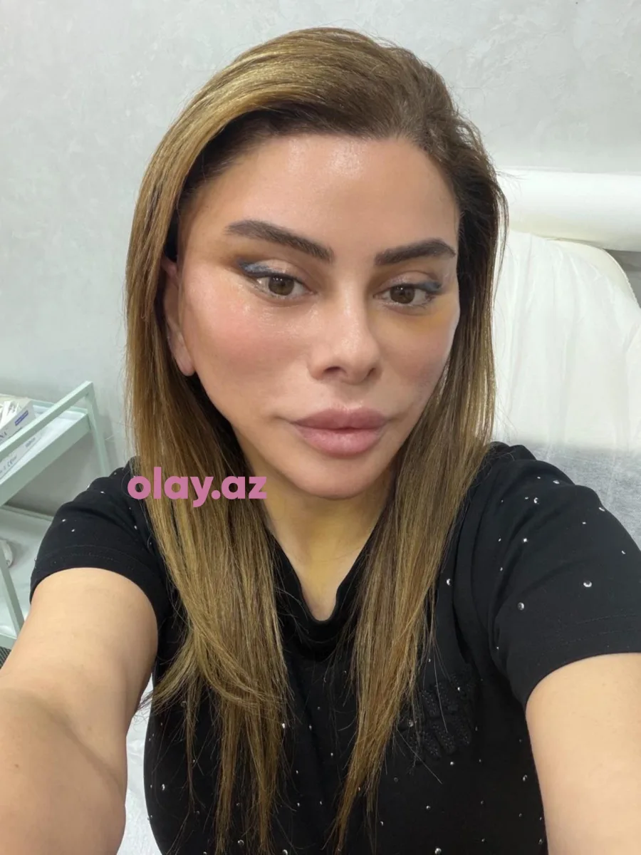 Üzgərmə əməliyyatı etdirdilər!