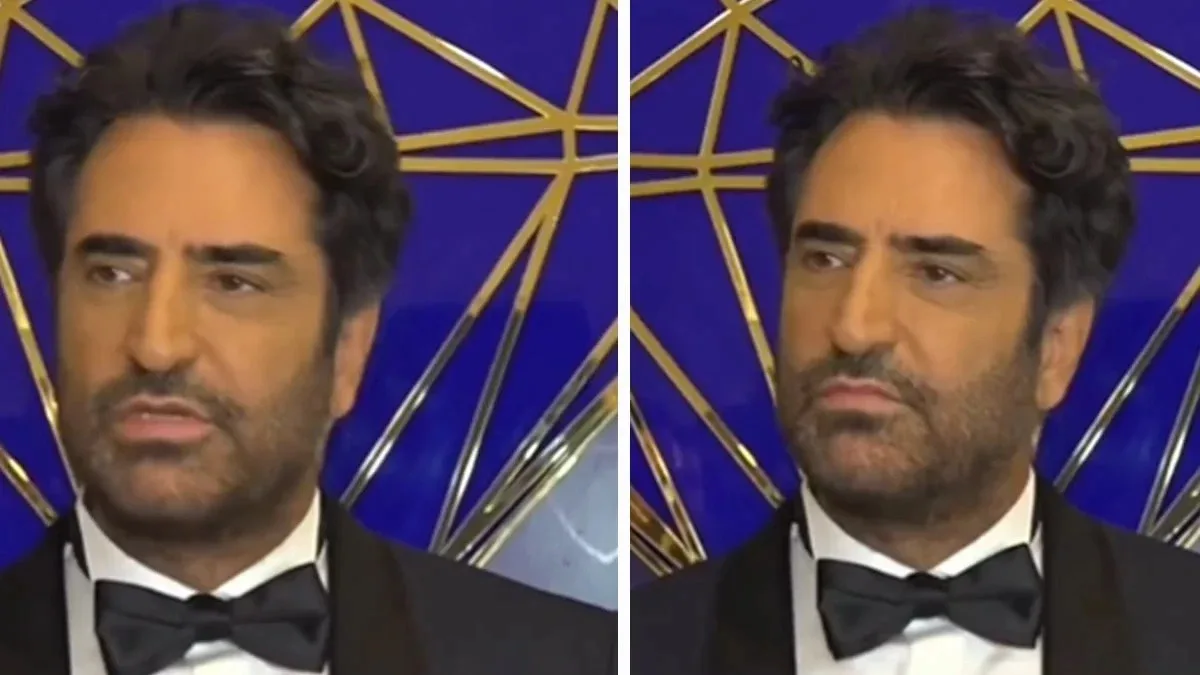 Mahsun Kırmızıgül botoks etdirib? - Foto