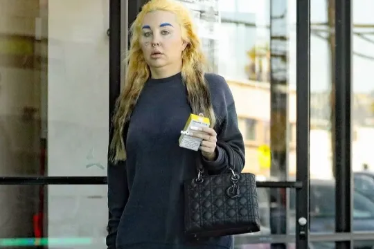 Məşhur aktrisa psixoloji xəstəlikdən sonra