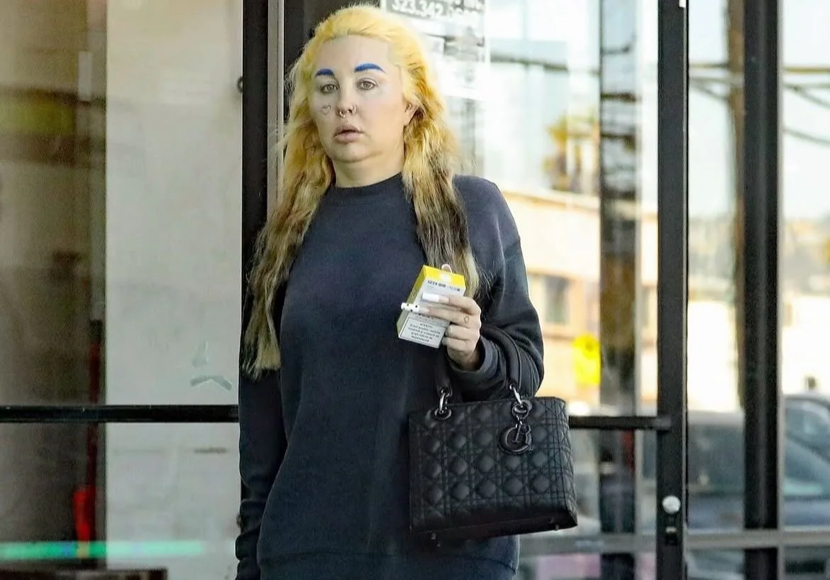 Məşhur aktrisa psixoloji xəstəlikdən sonra