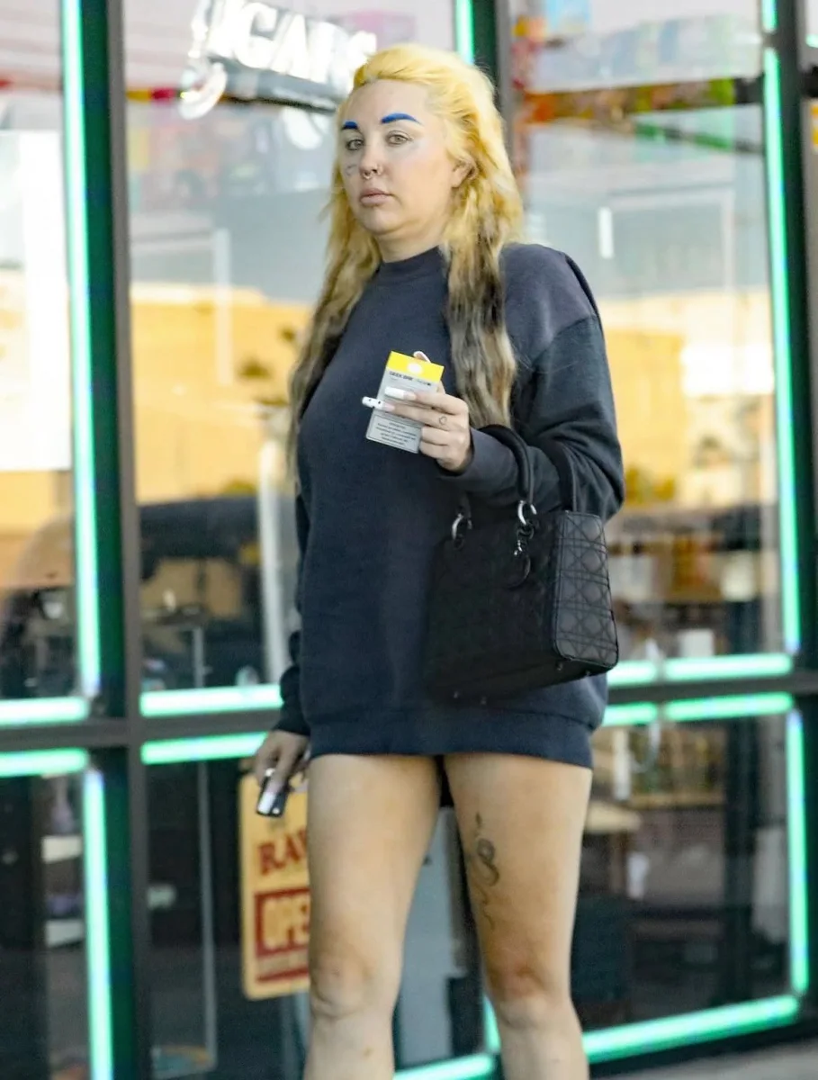 Məşhur aktrisa psixoloji xəstəlikdən sonra