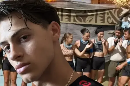 “Survivor” iştirakçısının ayağı amputasiya edildi!