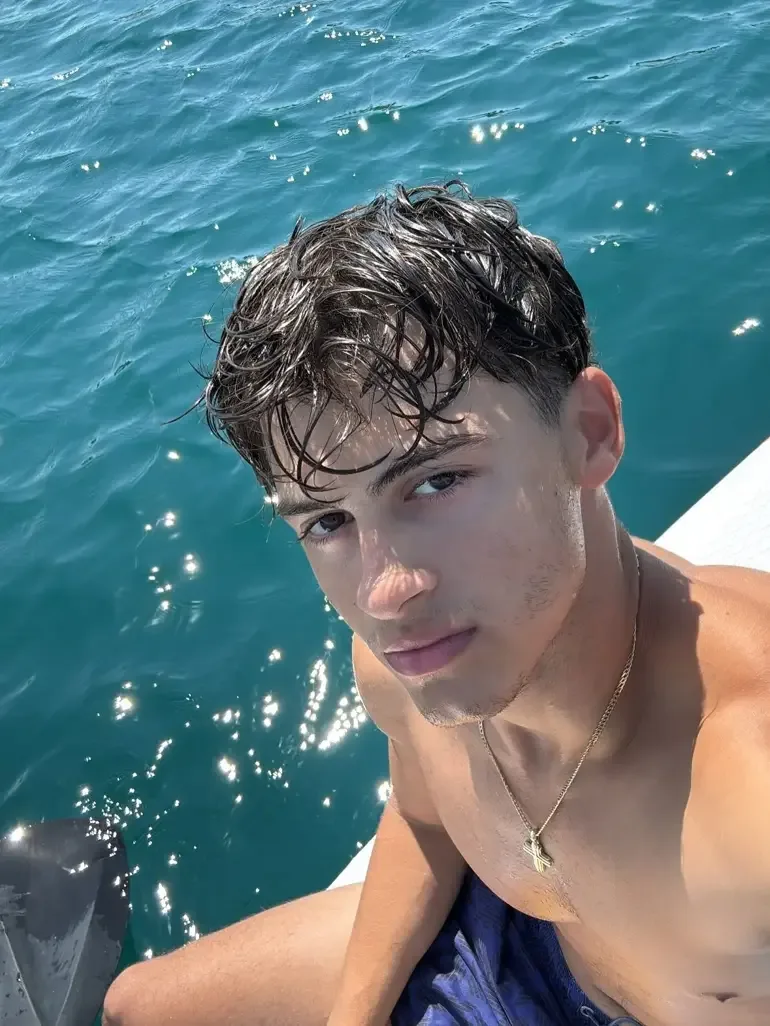 “Survivor” iştirakçısının ayağı amputasiya edildi!