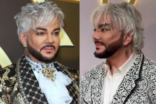 Kirkorov plastik əməliyyat etdirib? - Foto