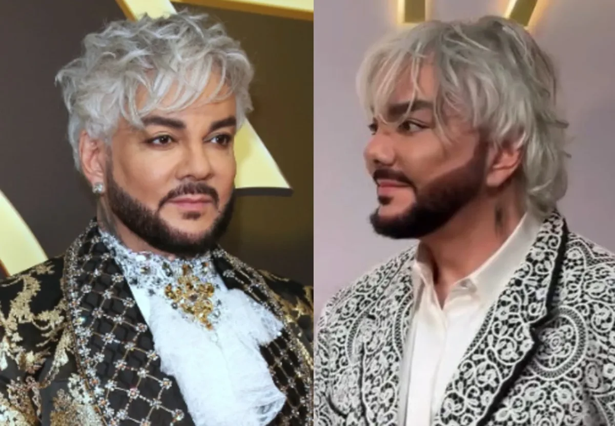 Kirkorov plastik əməliyyat etdirib? - Foto