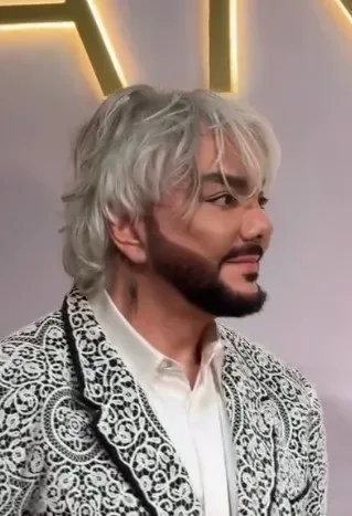 Kirkorov plastik əməliyyat etdirib? - Foto