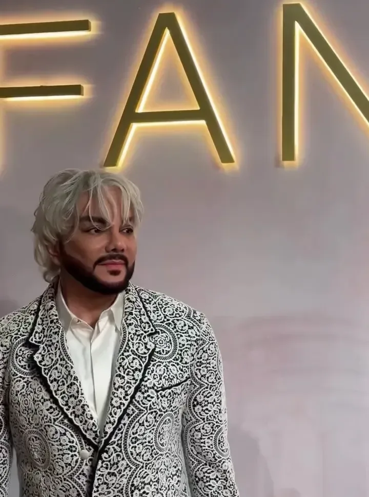 Kirkorov plastik əməliyyat etdirib? - Foto