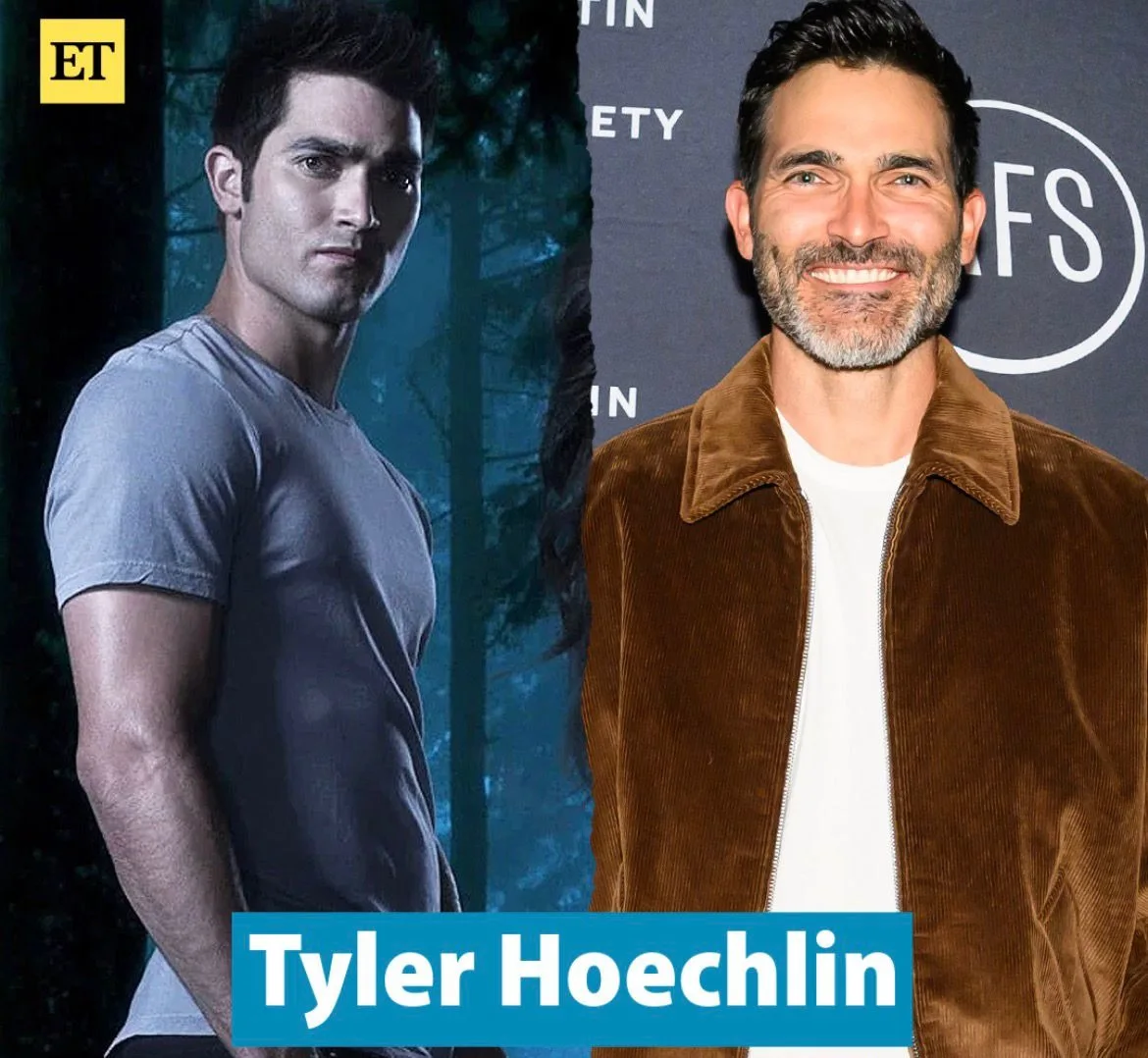 “Teen Wolf” aktyorları 15 il sonra…