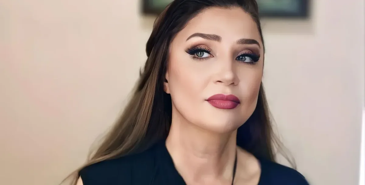 Əməkdar artist itini axtarır