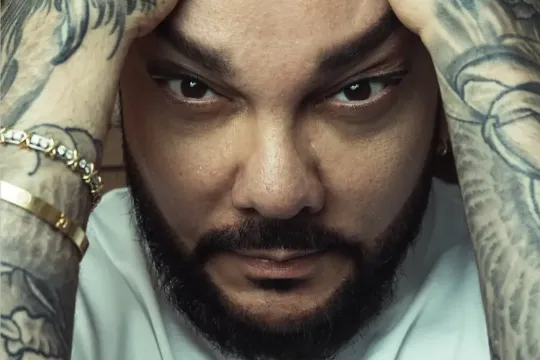 Kirkorov əməliyyatdan sonra…